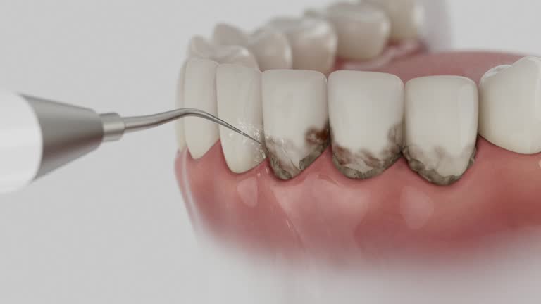 Reliable Dental Implants contractor in Kill Devil Hills, NC by Smile Center Dentistry